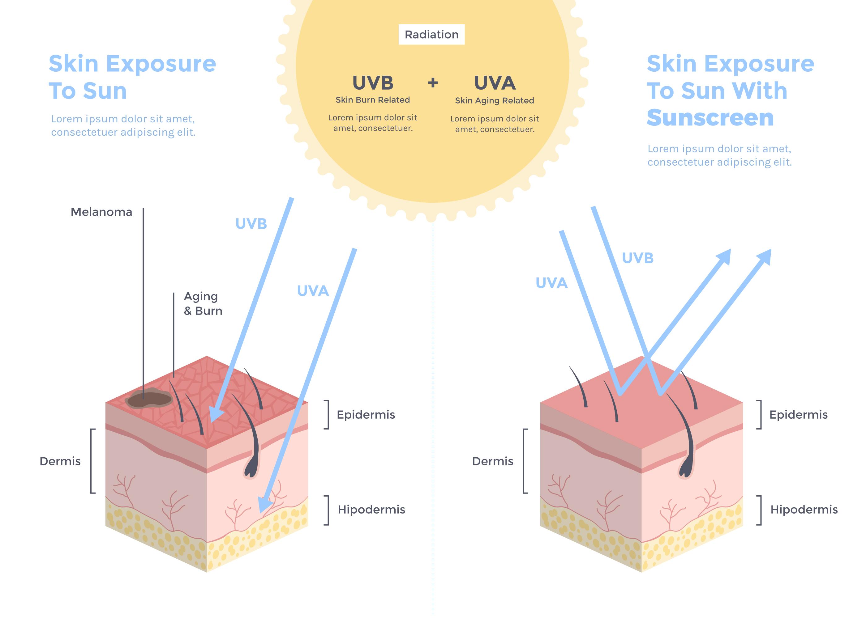 Unveiling the Secrets of Sun Damage: A Comprehensive Guide